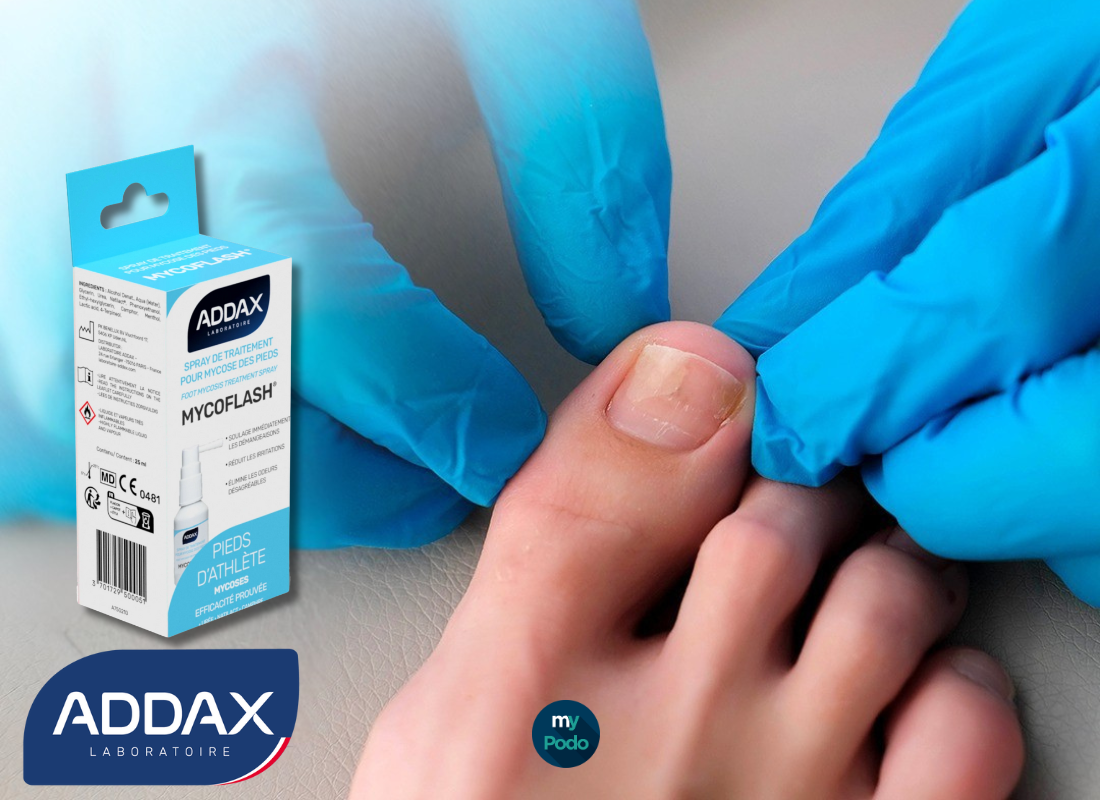 Mycoses des ongles : Laboratoire Addax, grands gagnants selon ALLOPODO !