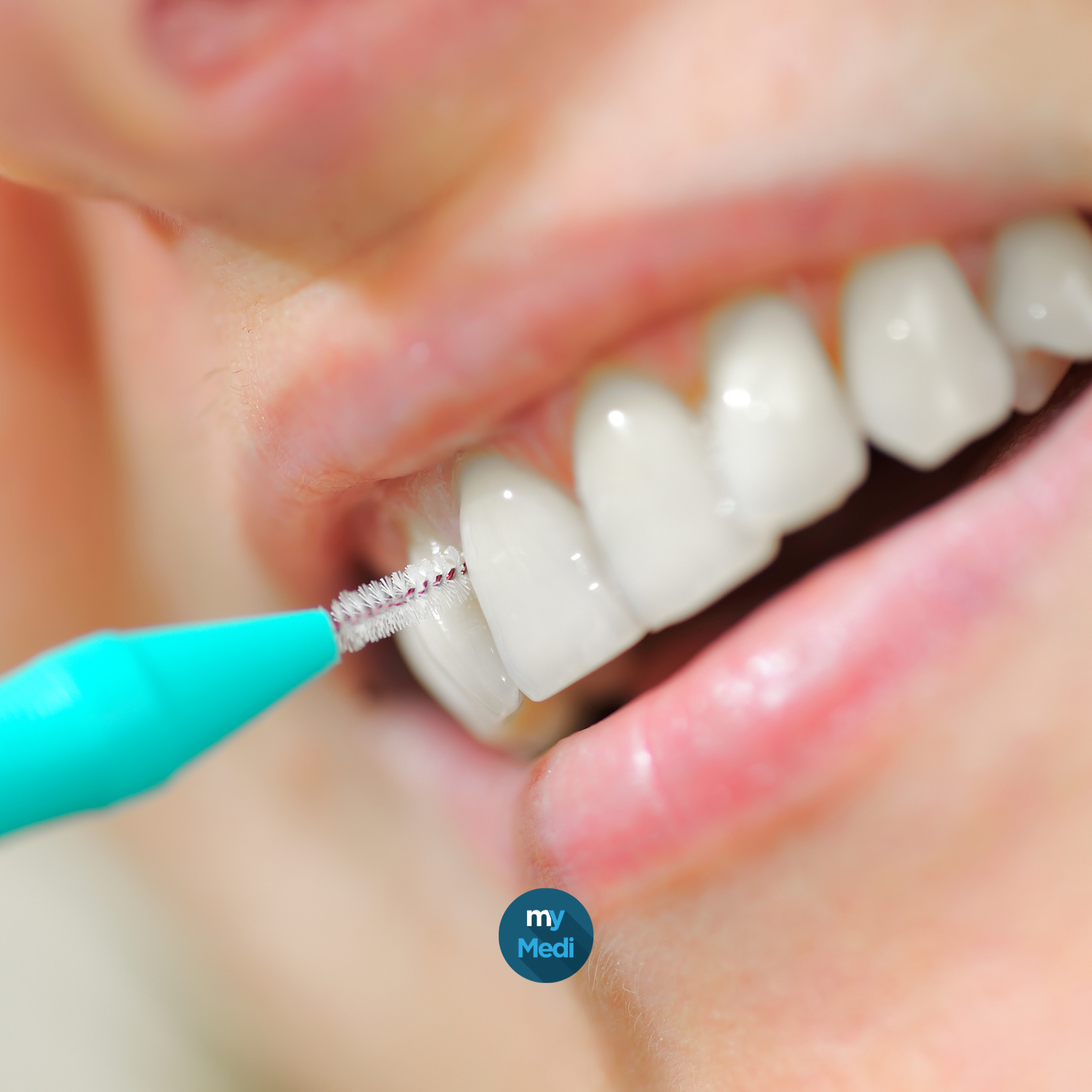 Brossettes interdentaires