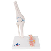 Mini-articulation du genou avec coupe transversale, sur socle - Anatomie et pathologie
