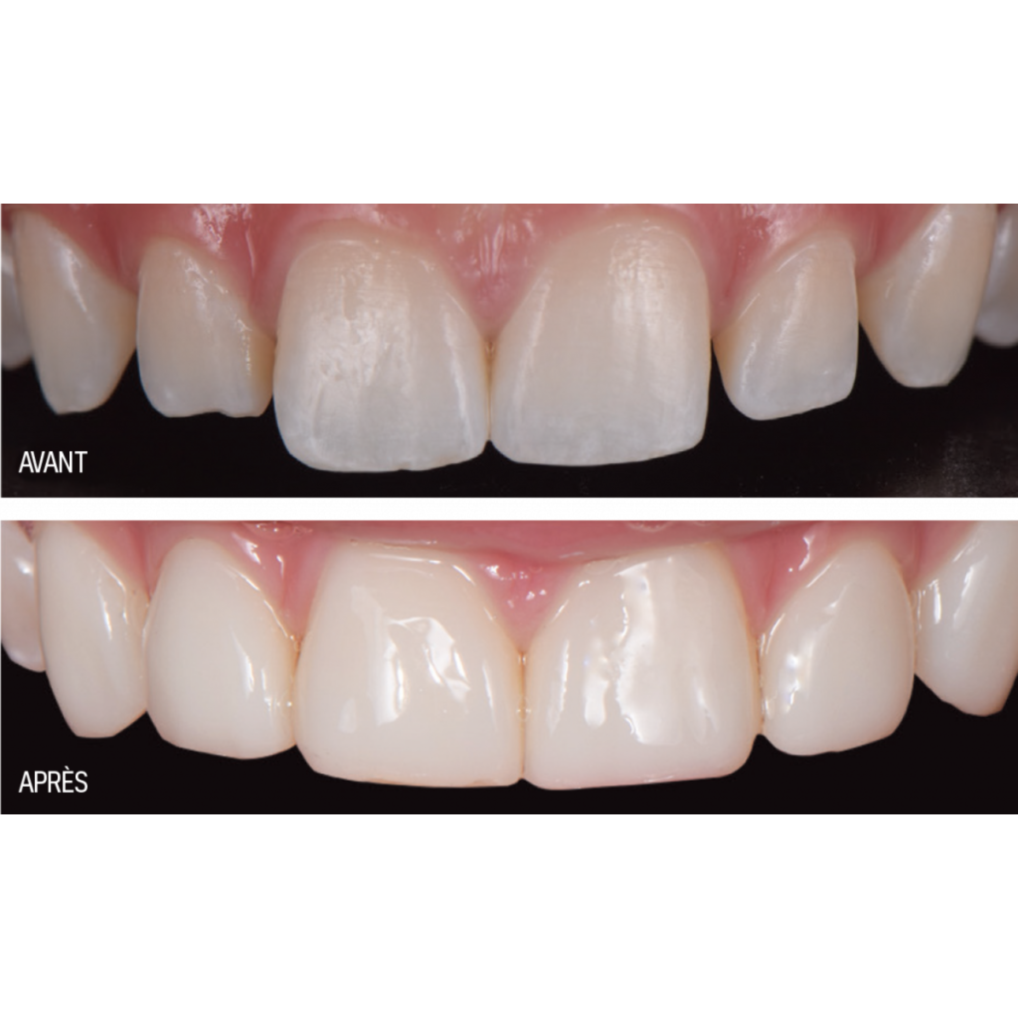 Luna 2 - composite universel - 4 g - SDI