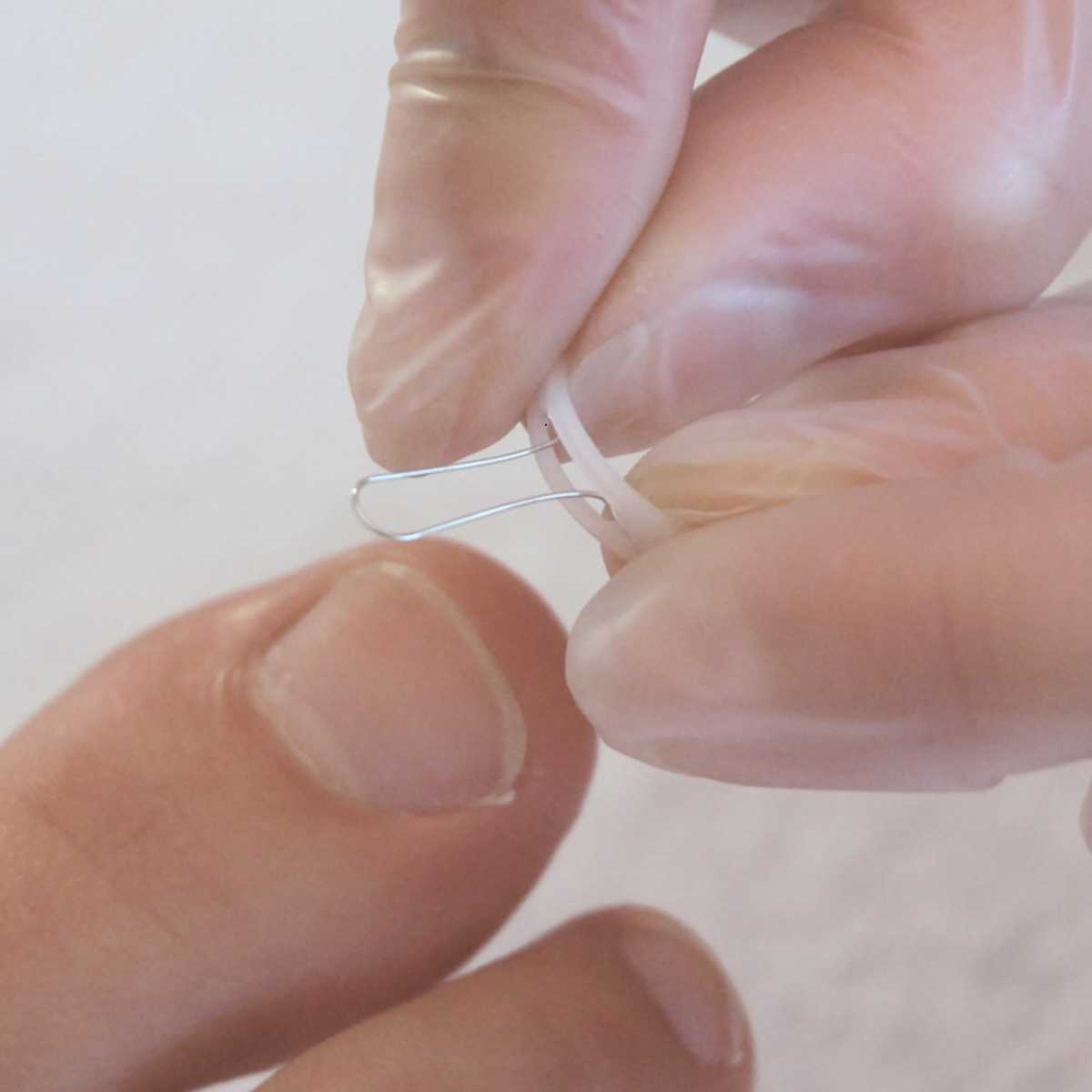 Languettes d’orthonyxie pour ongles incarnés et déformés - Différentes tailles - Podofix - My Médical