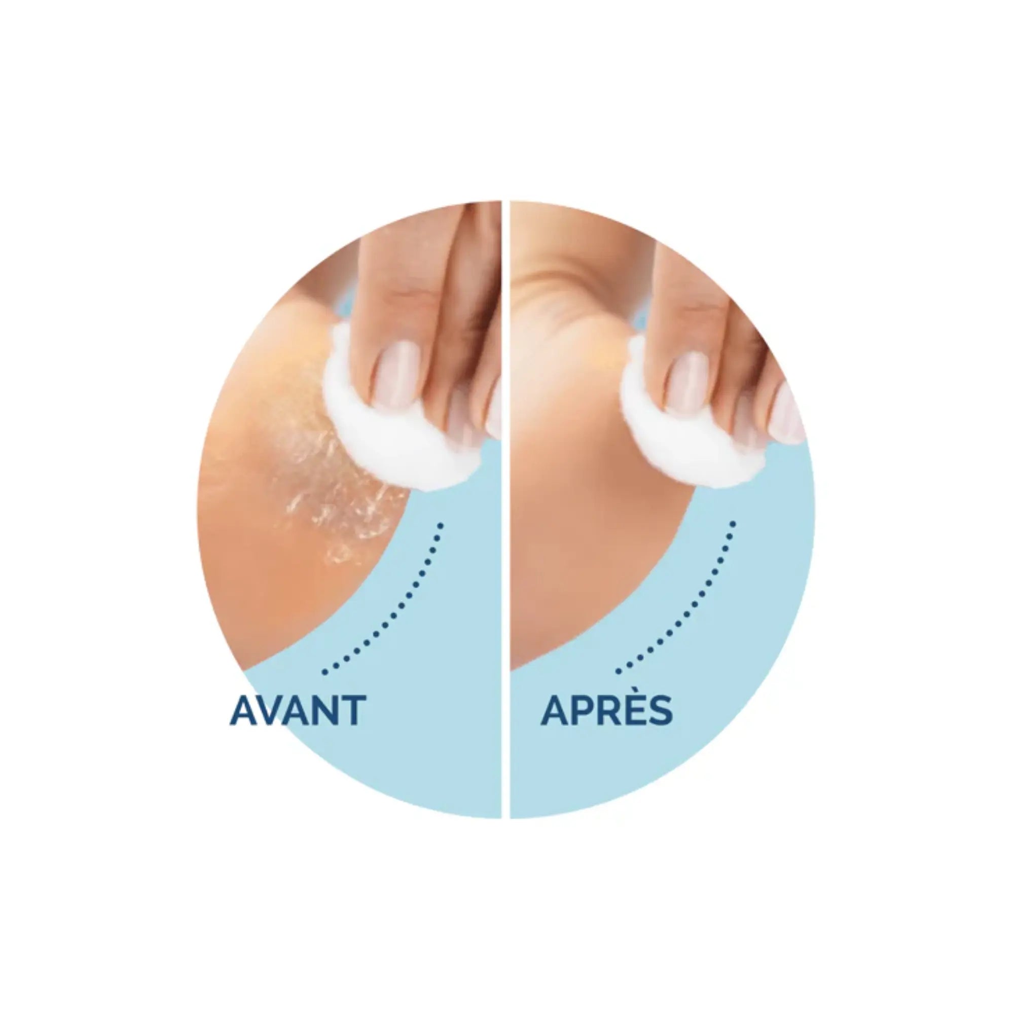 Recharge Rouleau Grain Ultra-Exfoliant - Râpe de Pédicurie Électrique - Velvet Smooth - Scholl