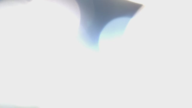 Load video: Lampe d'examen Visiano 20 Derungs - 60 000 lux - Waldmann
